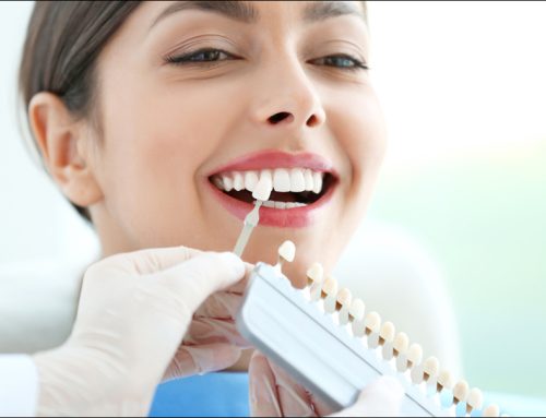 Achieving Perfect Color Matching for Bridges, Crowns, and Dentures